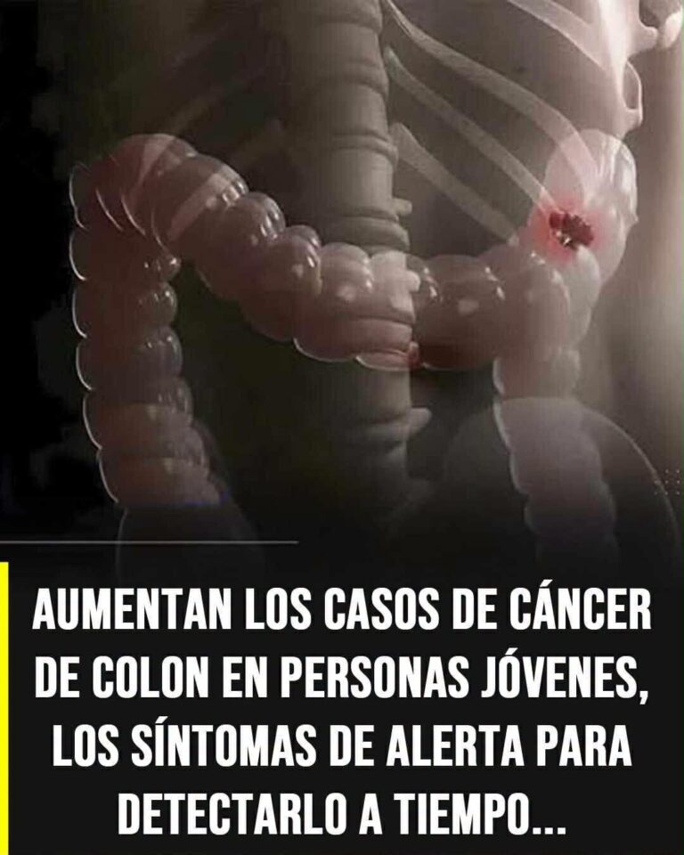 Cáncer de colon: señales de alerta temprana que merecen atención médica